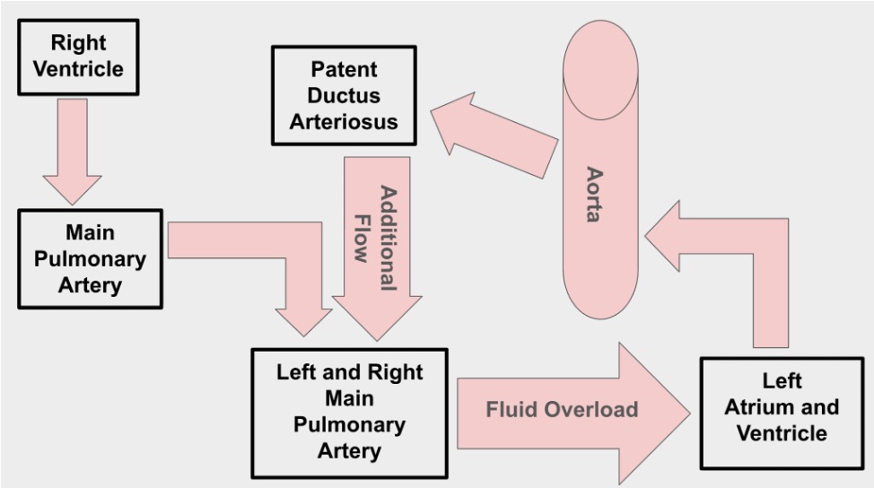 Patent ductus