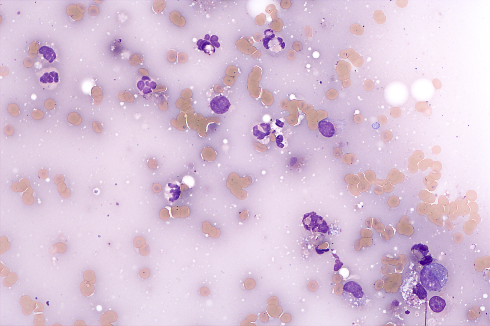 Microscopic image of left kidney cytology 